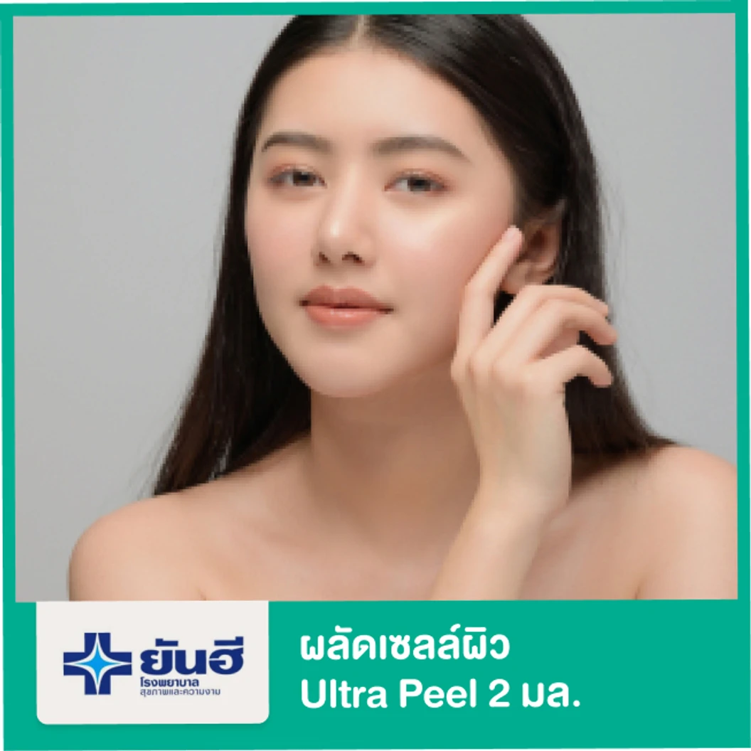 ผลัดเซลล์ผิว ด้วย Ultra Peel 2 มล.