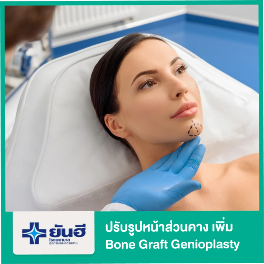 ปรับรูปหน้าส่วนคาง เพิ่ม Bone Graft Genioplasty