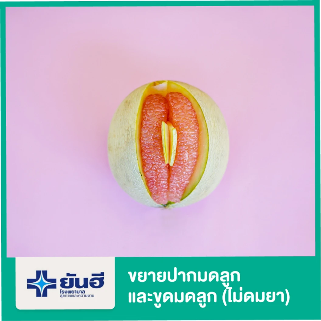ขยายปากมดลูกและขูดมดลูก (ไม่ดมยา)