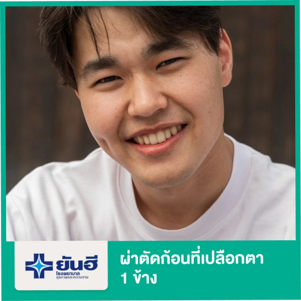 ผ่าตัดก้อนที่เปลือกตา สำหรับตา 1 ข้าง