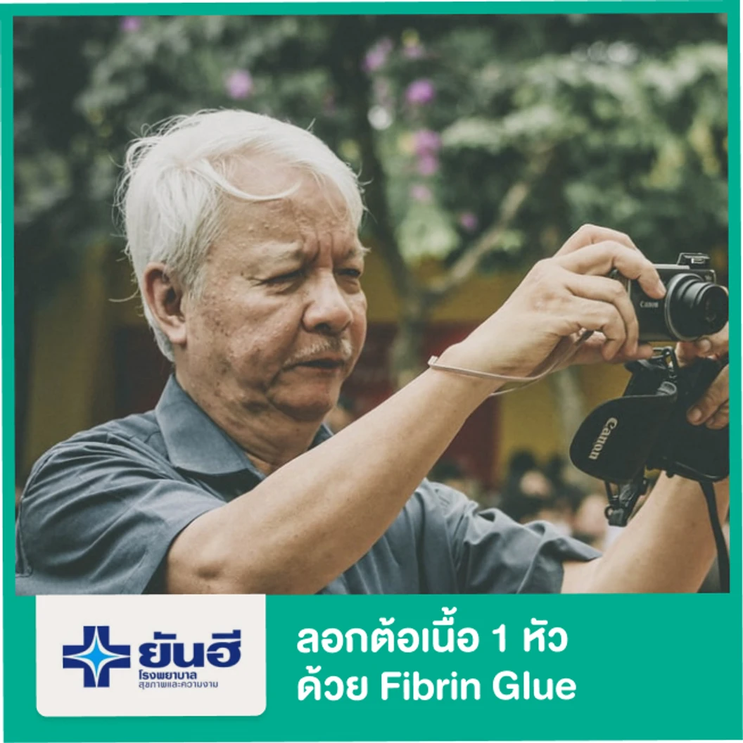 ลอกต้อเนื้อ 1 หัว โดยใช้ Fibrin Glue