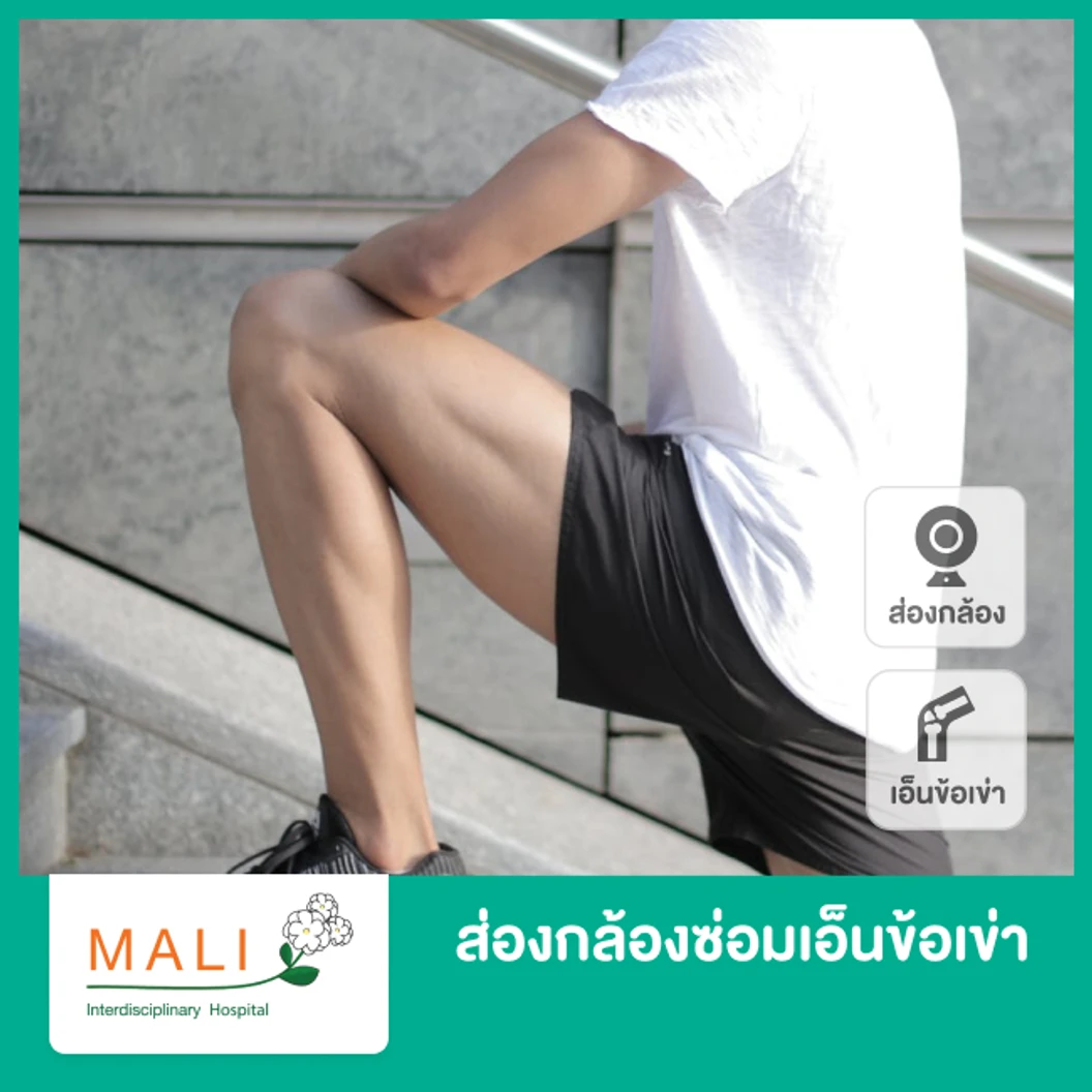 ส่องกล้องซ่อมเอ็นข้อเข่า Asthroscope ACL of Knee