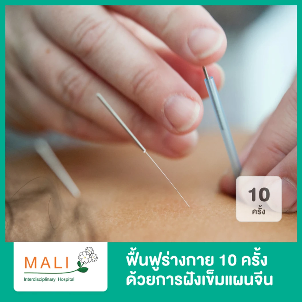 คอร์สฟื้นฟูร่างกาย ด้วยการฝังเข็มแผนจีน TCM REHAB 10 ครั้ง