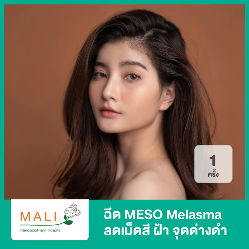 โปรแกรม MESO Melasma ยับยั้งเม็ดสี ลดฝ้า กระ จุดด่างดำ 1 ครั้ง ฟรี! 1 ครั้ง