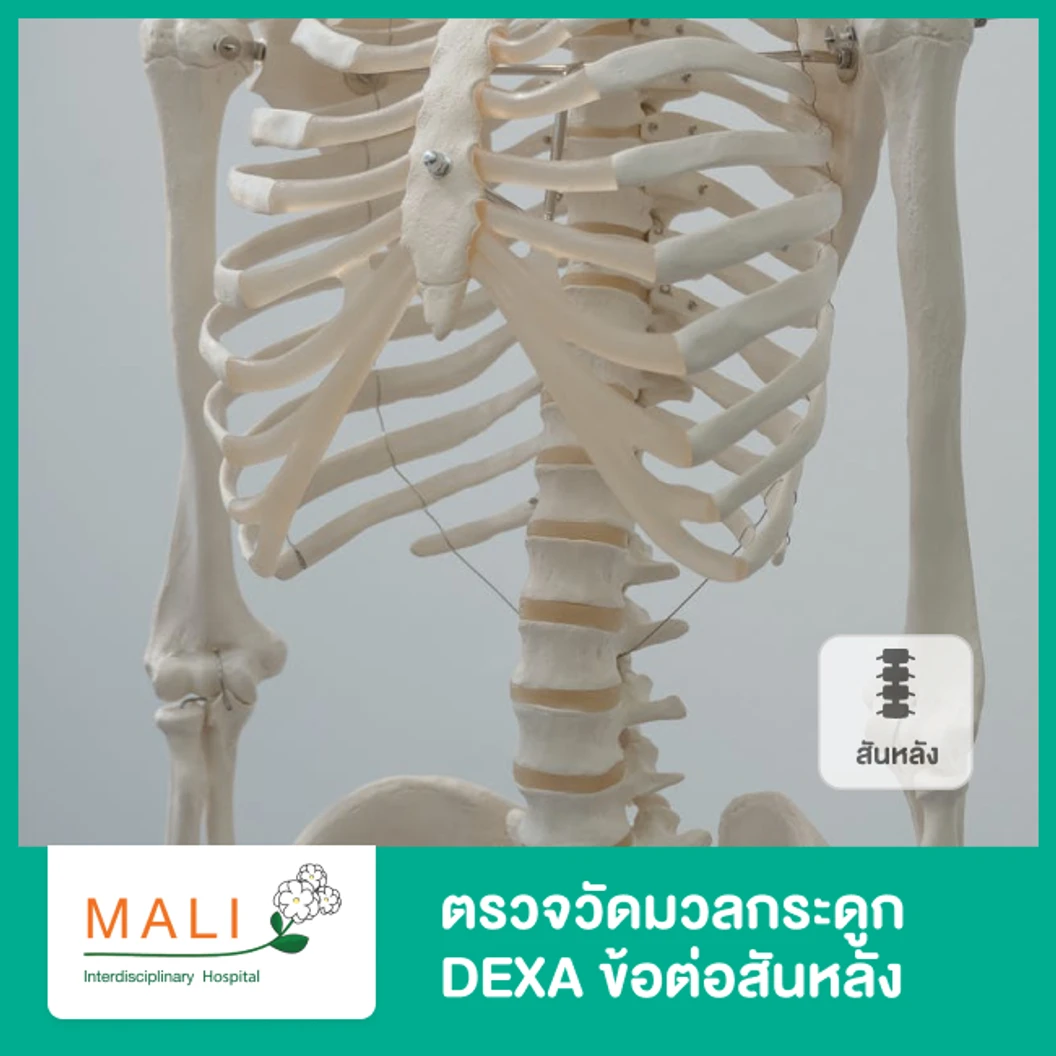 ตรวจวัดมวลกระดูก DEXA ข้อต่อสันหลังแต่ละข้อ (IVA)