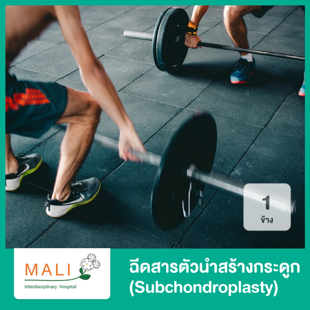 ฉีดสารตัวนำสร้างกระดูก (Subchondroplasty) 1 ข้าง
