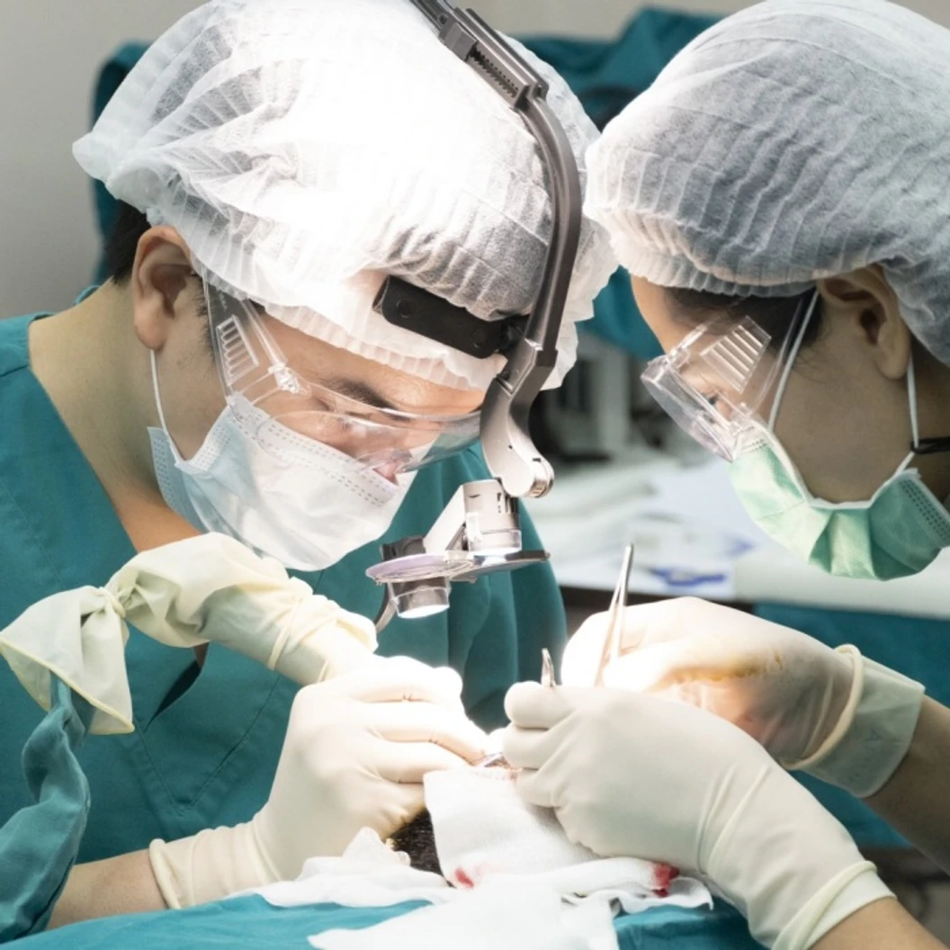 ปลูกผม ด้วยเทคนิค FUE ไม่เกิน 1,500 กราฟต์