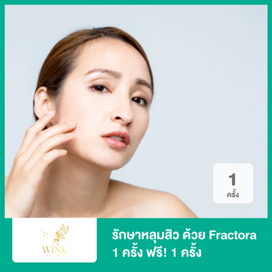 รักษาหลุมสิว กระชับรูขุมขน ปรับผิวเรียบเนียน ด้วย Fractora 1 ครั้ง ฟรี! 1 ครั้ง
