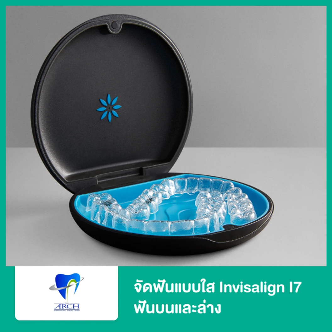 จัดฟันแบบใส Invisalign i7 ฟันบนและล่าง