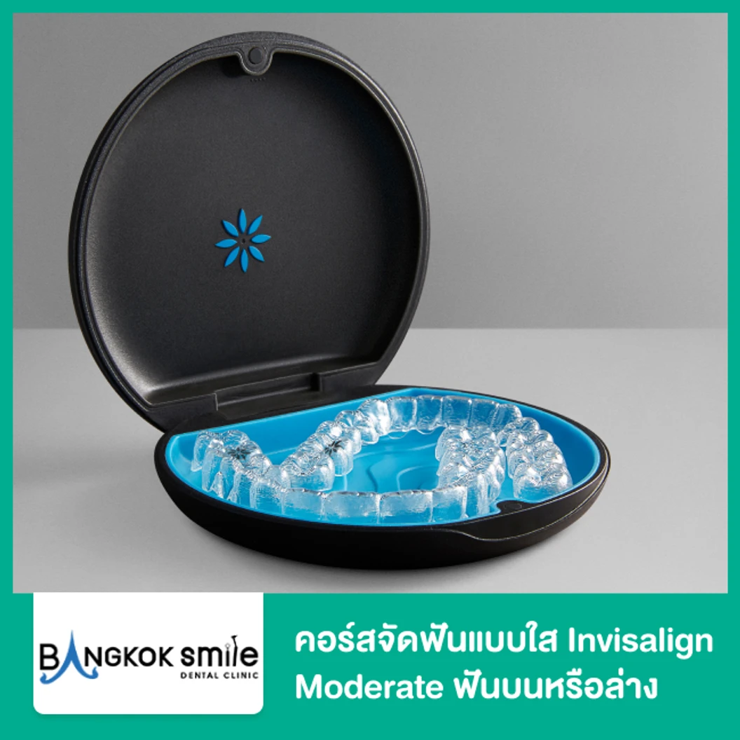 คอร์สจัดฟันแบบใส Invisalign Moderate ฟันบนหรือล่าง เครื่องมือ 26 ชิ้น