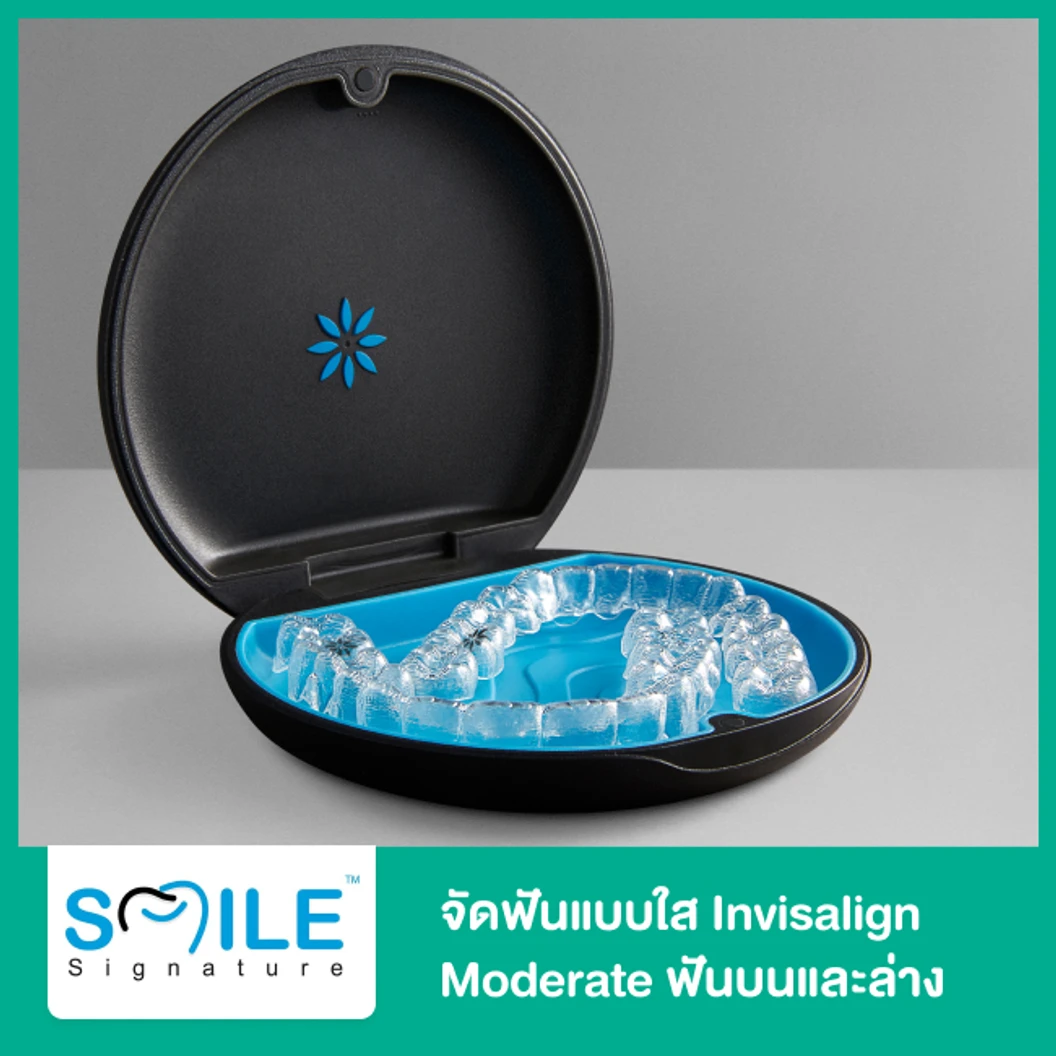 จัดฟันแบบใส Invisalign Moderate ฟันบนและล่าง