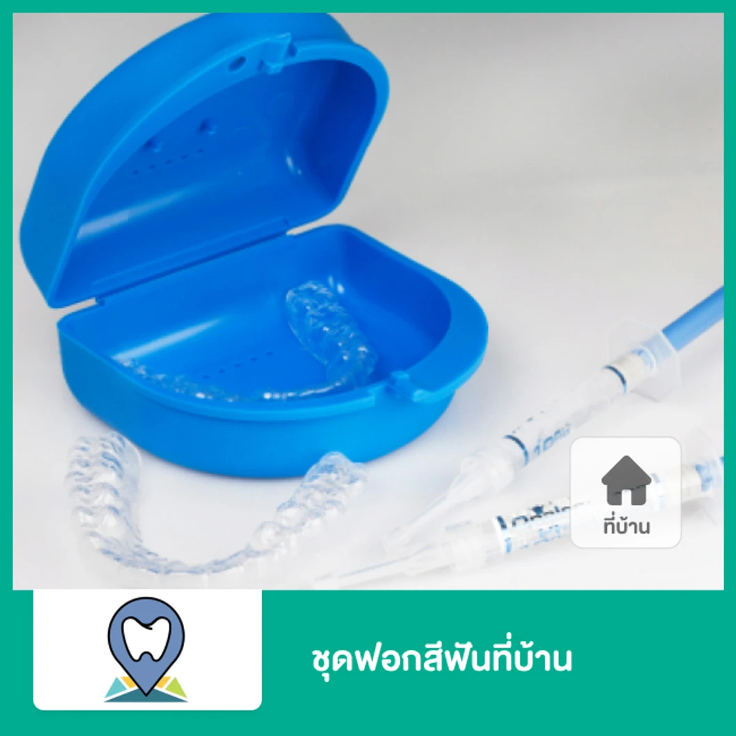 ชุดฟอกสีฟันที่บ้าน