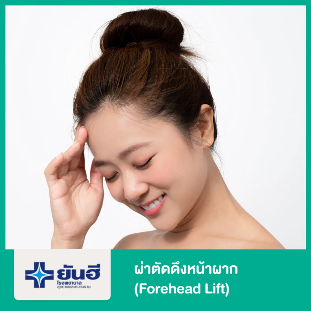 ดึงหน้าผาก รวมแก้หว่างคิ้ว (Forehead Lift)