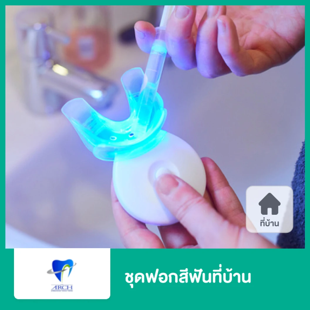 ชุดฟอกสีฟันที่บ้าน