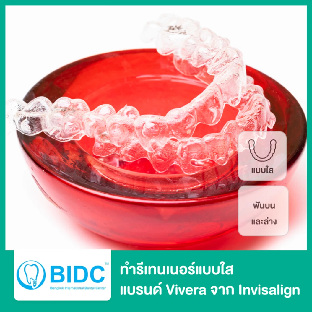 ทำรีเทนเนอร์แบบใส แบรนด์ Vivera จาก Invisalign ฟันบนและล่าง