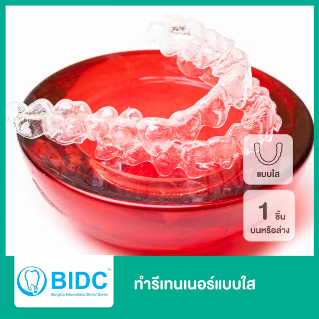 ทำรีเทนเนอร์แบบใส 1 ชิ้น ฟันบนหรือล่าง