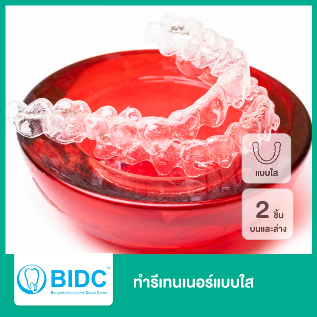 ทำรีเทนเนอร์แบบใส 2 ชิ้น ฟันบนและล่าง