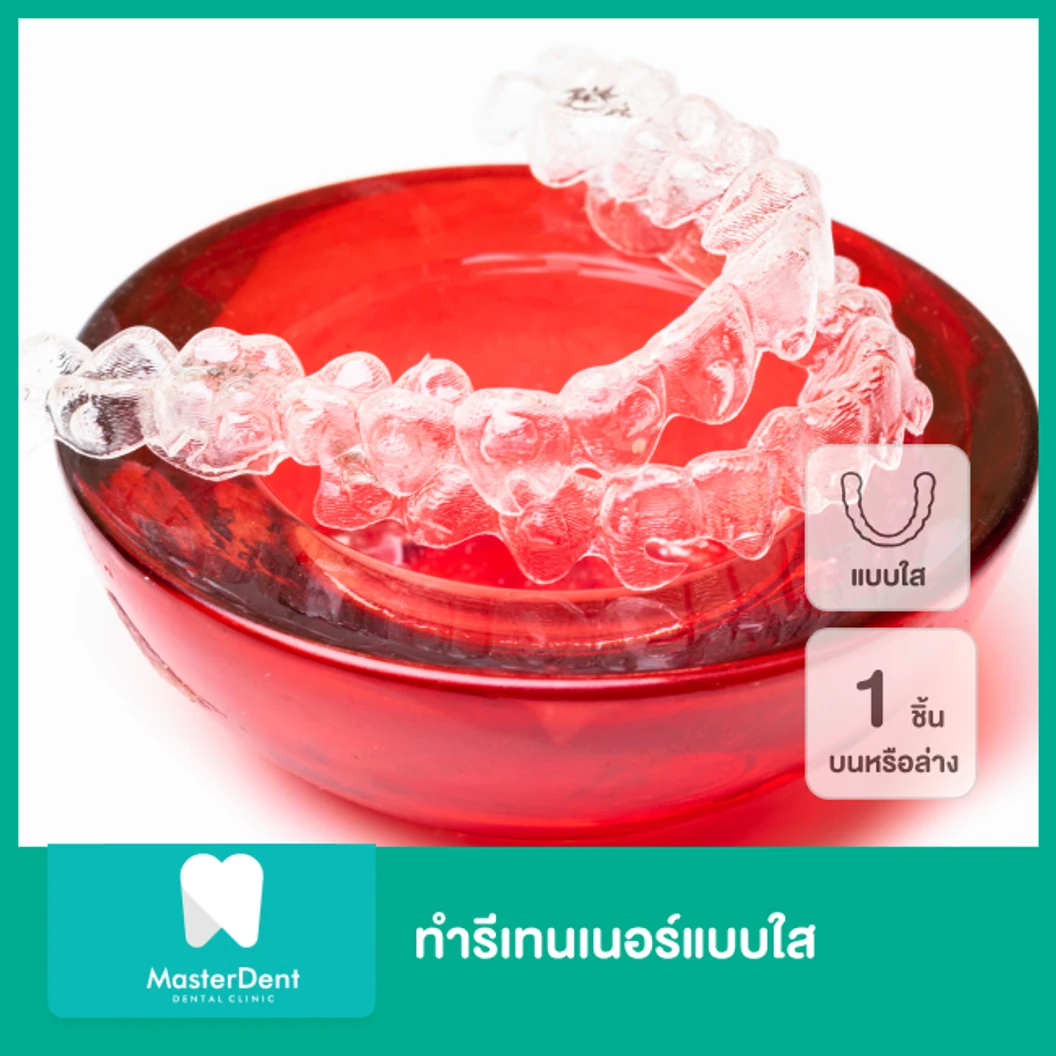 ทำรีเทนเนอร์แบบใส 1 ชิ้น ฟันบนหรือล่าง