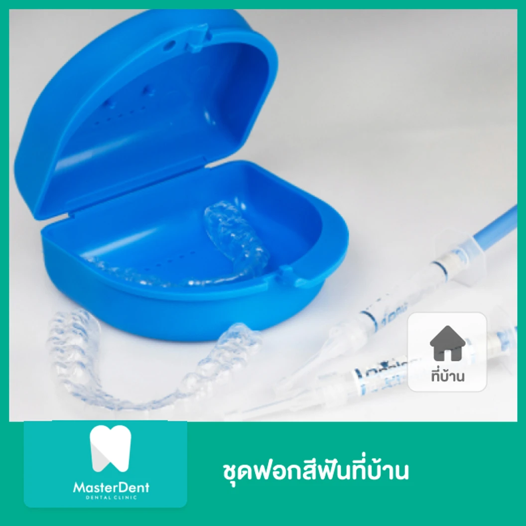 ชุดฟอกสีฟันที่บ้าน