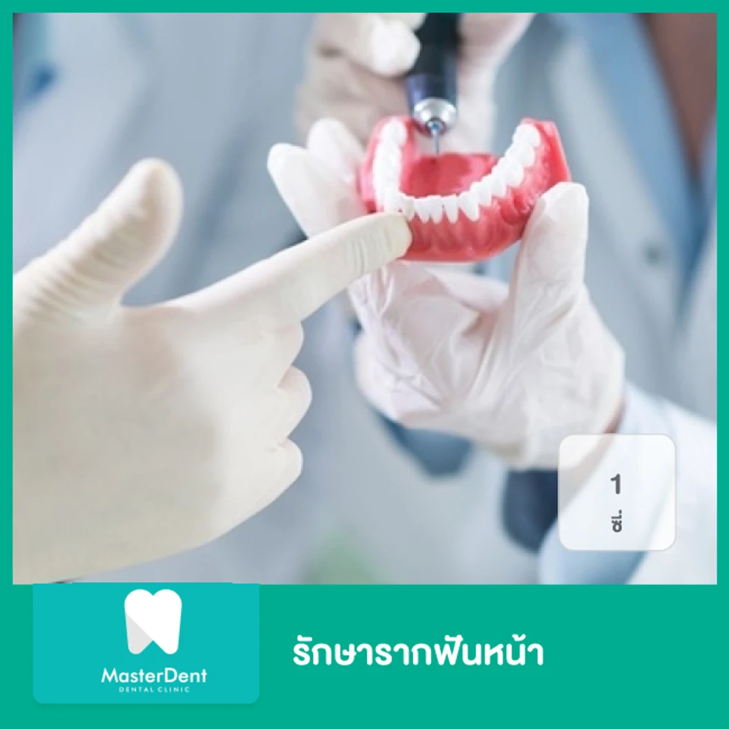 รักษารากฟันหน้า 1 ซี่