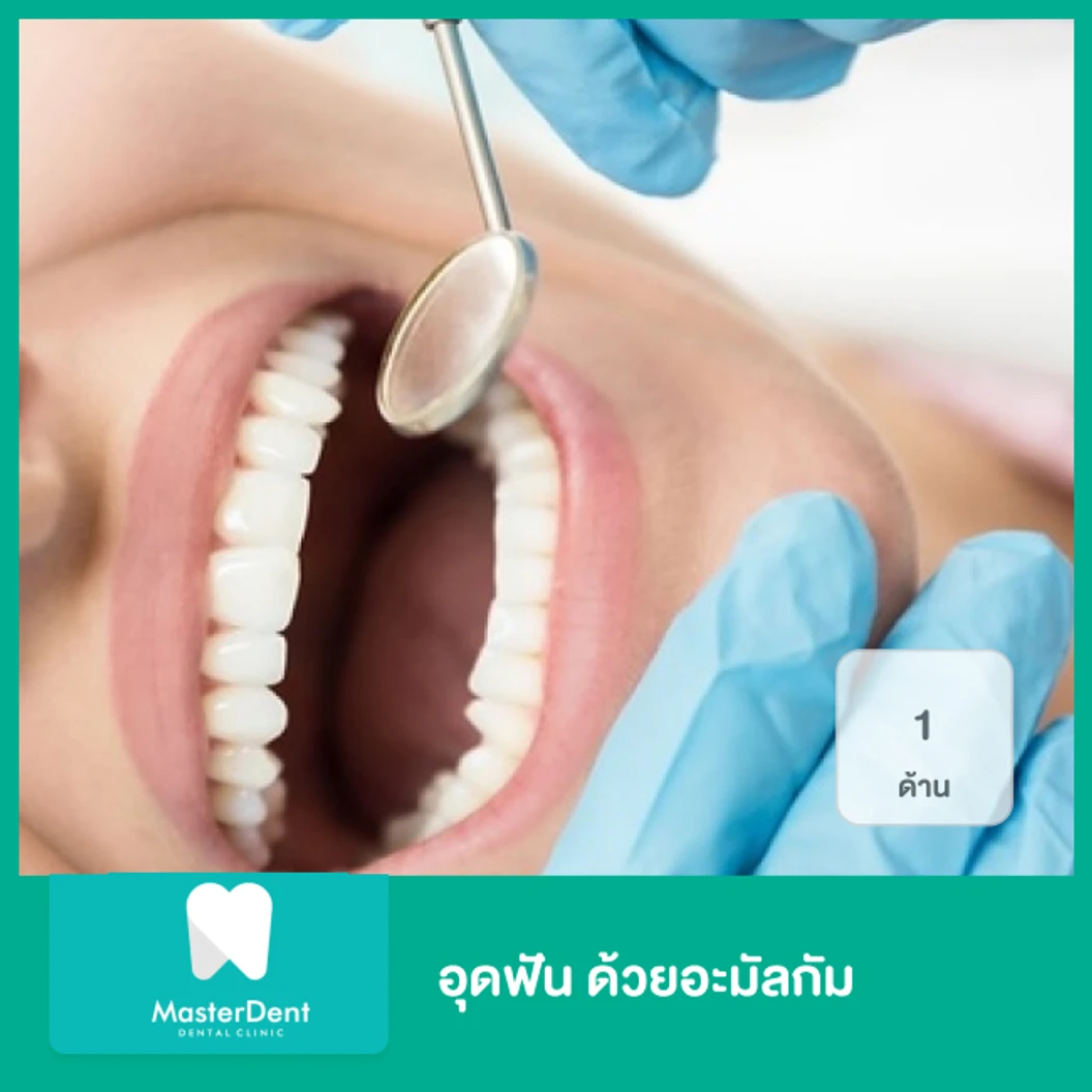 อุดฟัน ด้วยอะมัลกัม 1 ด้าน