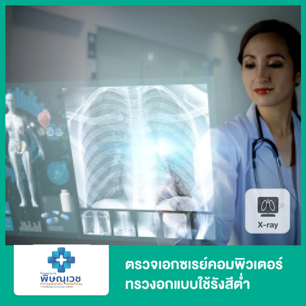 ตรวจเอกซเรย์คอมพิวเตอร์ทรวงอกแบบใช้รังสีต่ำ (Low-Dose CT)