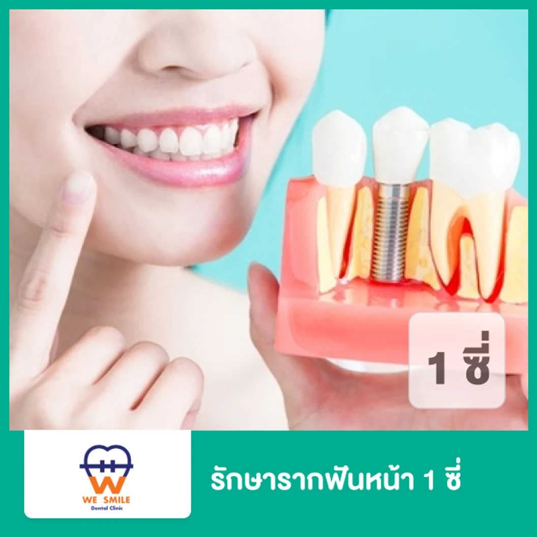 รักษารากฟันหน้า 1 ซี่