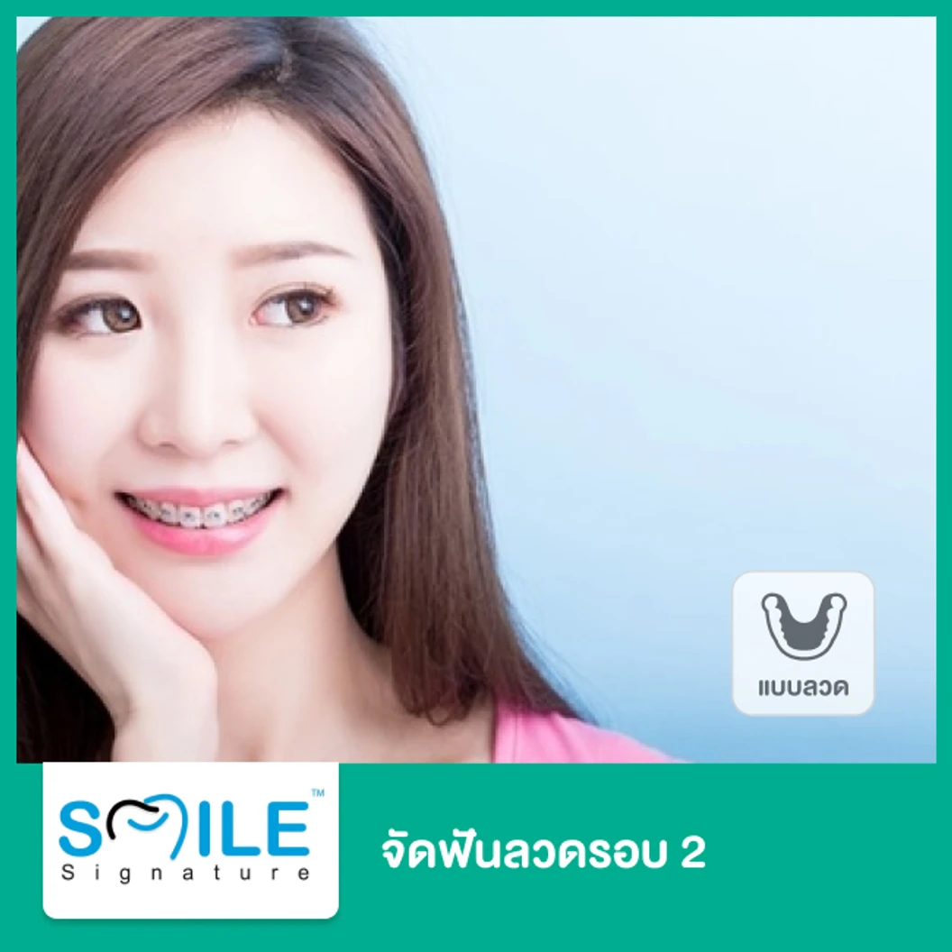 จัดฟันแบบโลหะรอบ 2