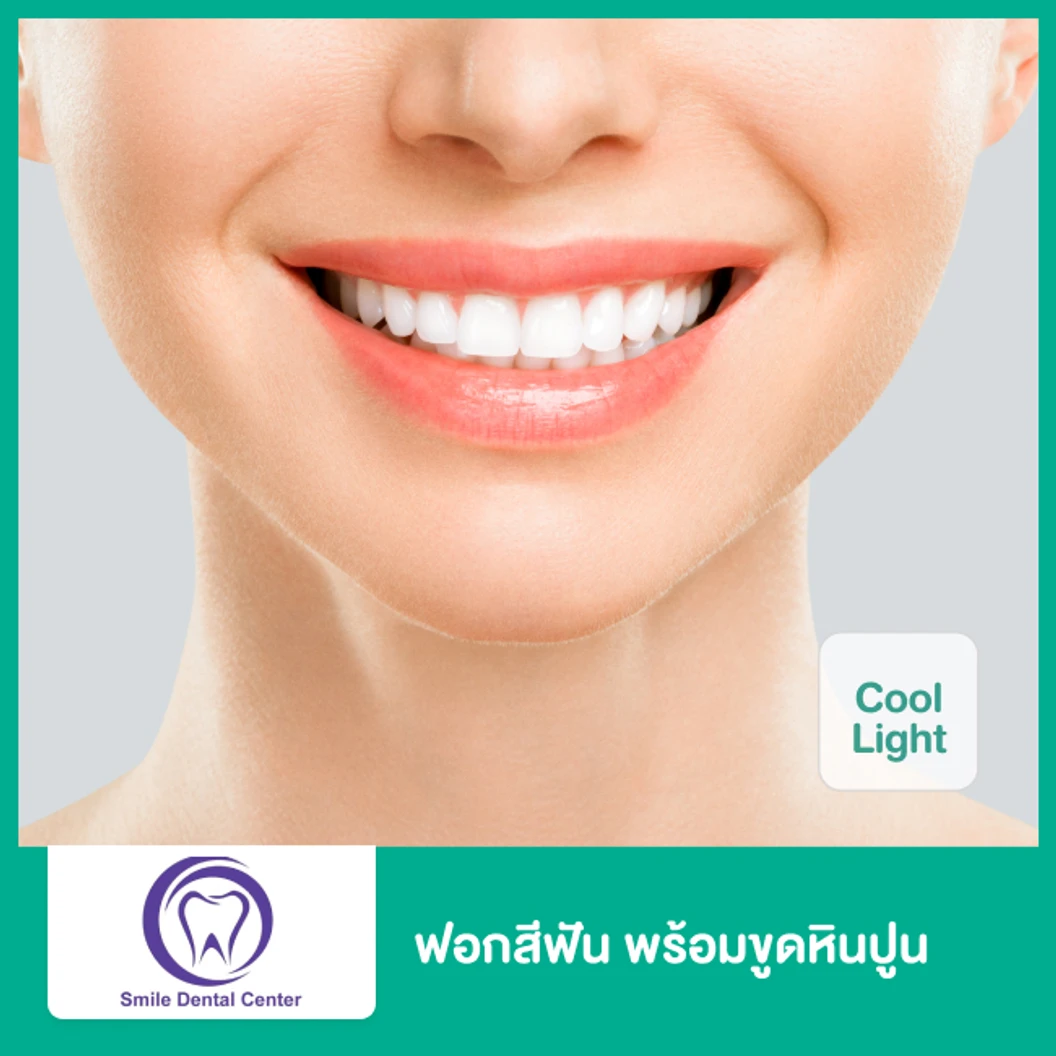ฟอกสีฟัน ด้วยระบบ Cool Light พร้อมขูดหินปูน