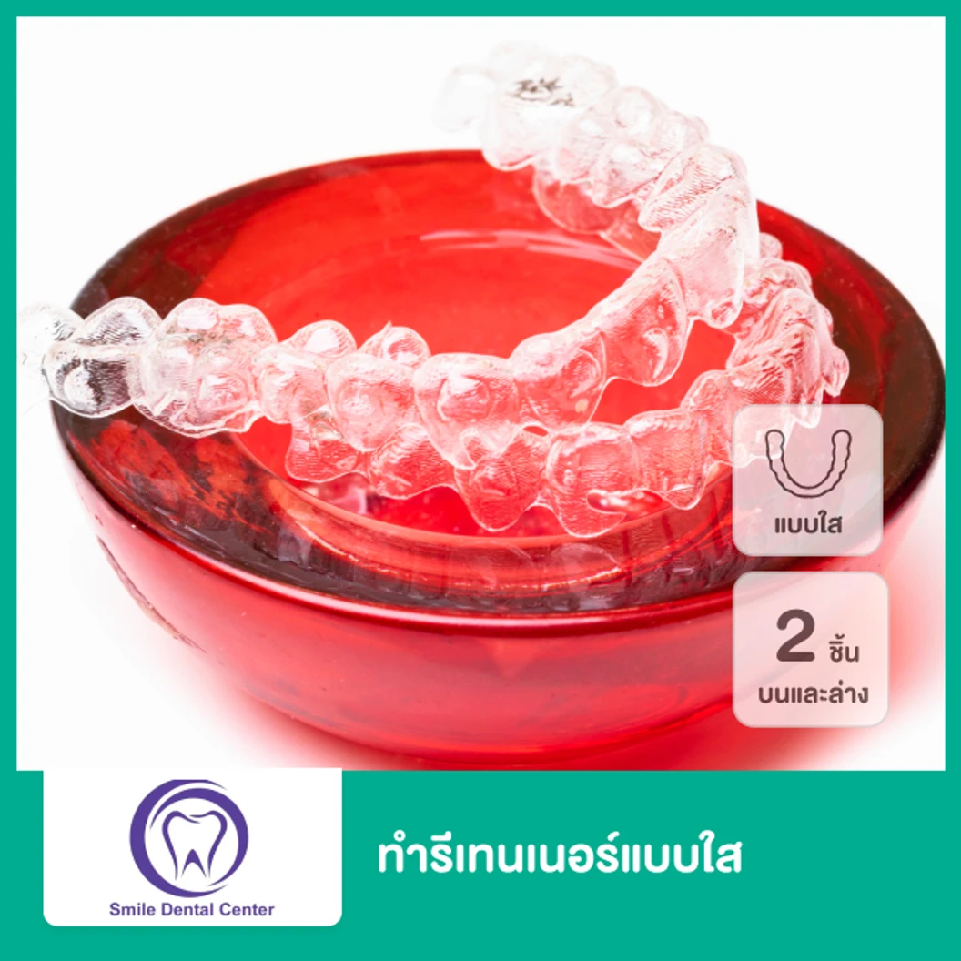 ทำรีเทนเนอร์แบบใส 2 ชิ้น ฟันบนและล่าง