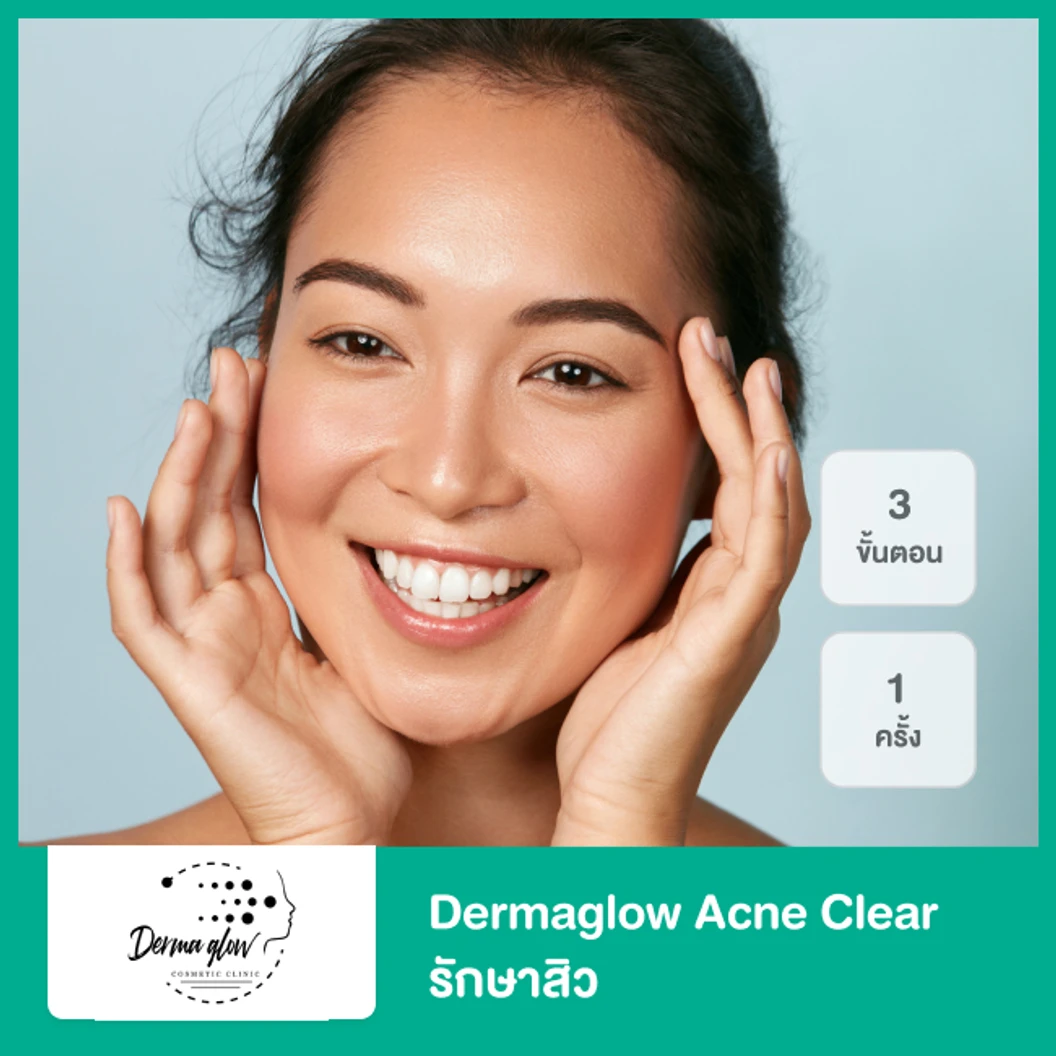 Dermaglow Acne Clear รักษาสิว 3 ขั้นตอน 1 ครั้ง