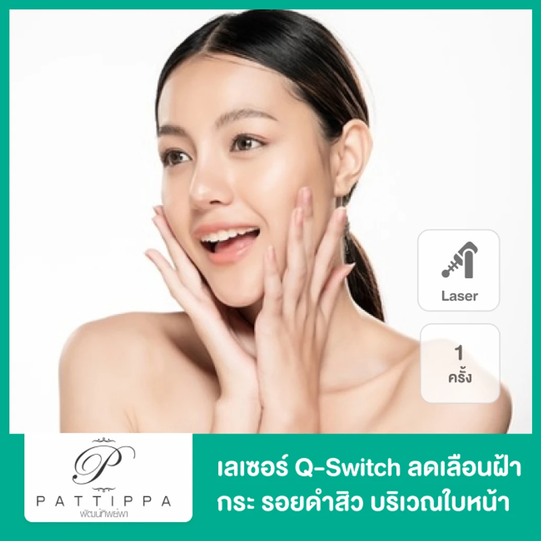 เลเซอร์ Q-switch ลดเลือนฝ้า​ กระ​ รอยดำสิว บริเวณใบหน้า 1 ครั้ง