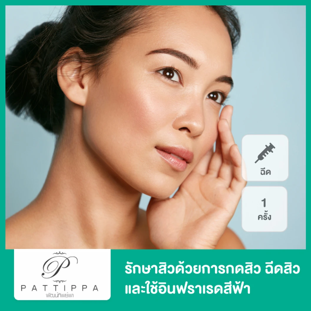Acne Treatment รักษาสิวด้วยการกดสิว ฉีดสิว และใช้อินฟราเรดสีฟ้า 1 ครั้ง