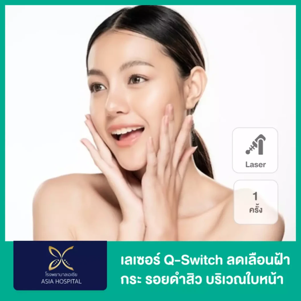 เลเซอร์ Q-Switch ลดเลือนฝ้า กระ รอยดำสิว บริเวณใบหน้า 1 ครั้ง