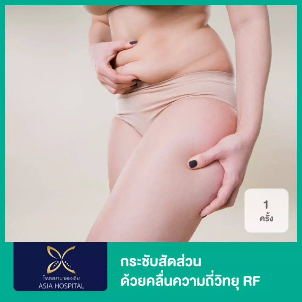 กระชับสัดส่วน บอกลาผิวเปลือกส้ม ด้วยคลื่นความถี่วิทยุ RF เครื่อง FormaPlus 1 ครั้ง