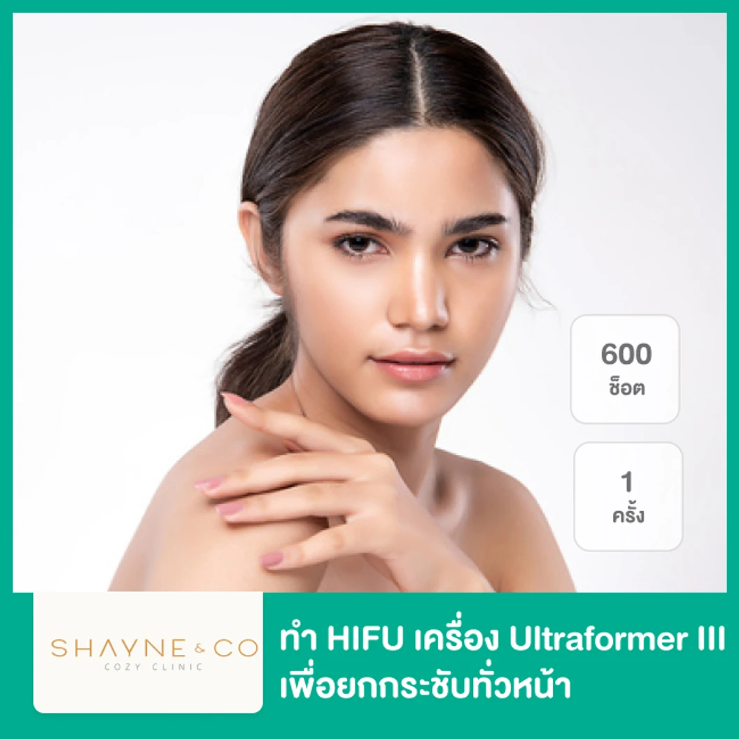 ทำ HIFU เครื่อง Ultraformer III 600 ช็อต เพื่อยกกระชับทั่วหน้า 1 ครั้ง