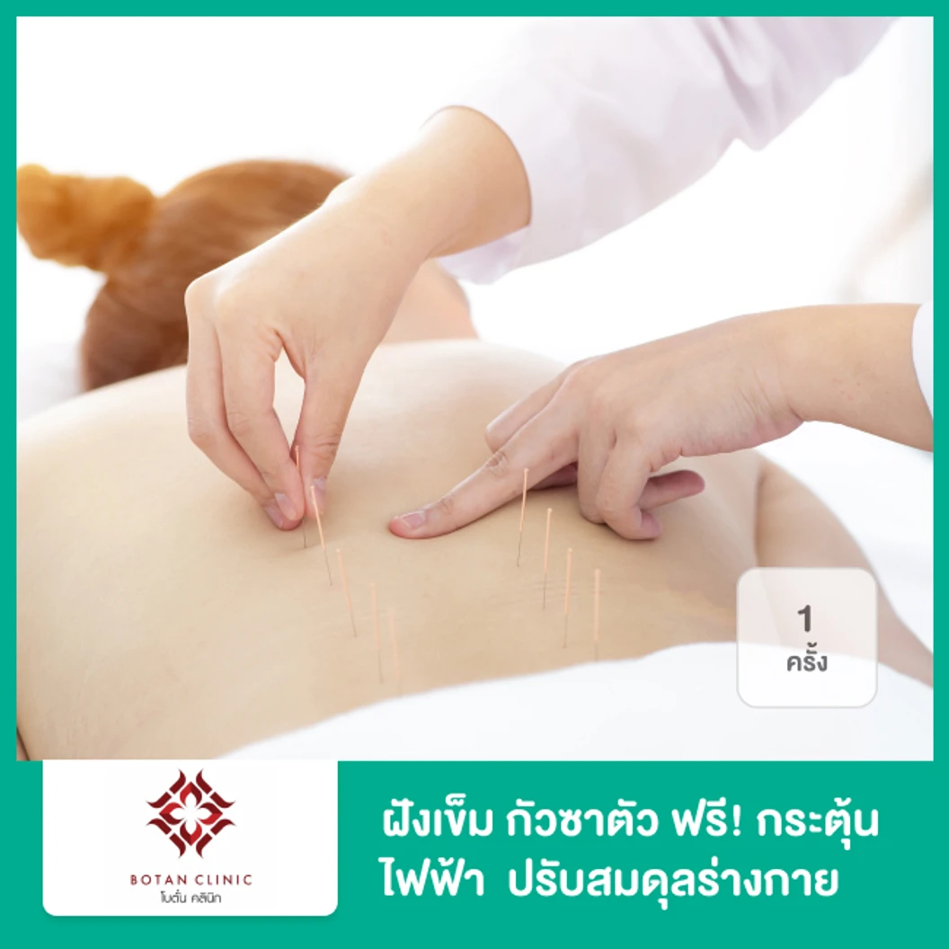 ฝังเข็ม กัวซาตัว ฟรี! กระตุ้นไฟฟ้า โคมอินฟาเรด ปรับสมดุลร่างกาย กระตุ้นการนอนหลับ ผ่อนคลาย 1 ครั้ง