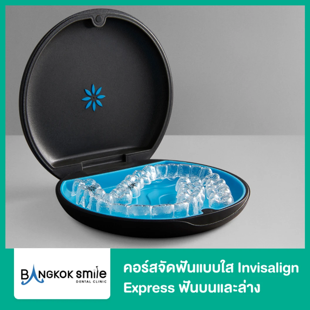 คอร์สจัดฟันแบบใส Invisalign Express ฟันบนและล่าง เครื่องมือ 14 ชิ้น