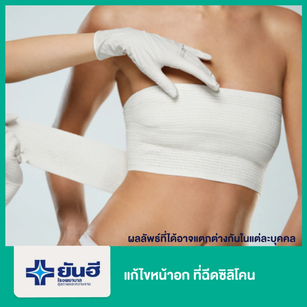 แก้ไขหน้าอกที่ฉีดซิลิโคน