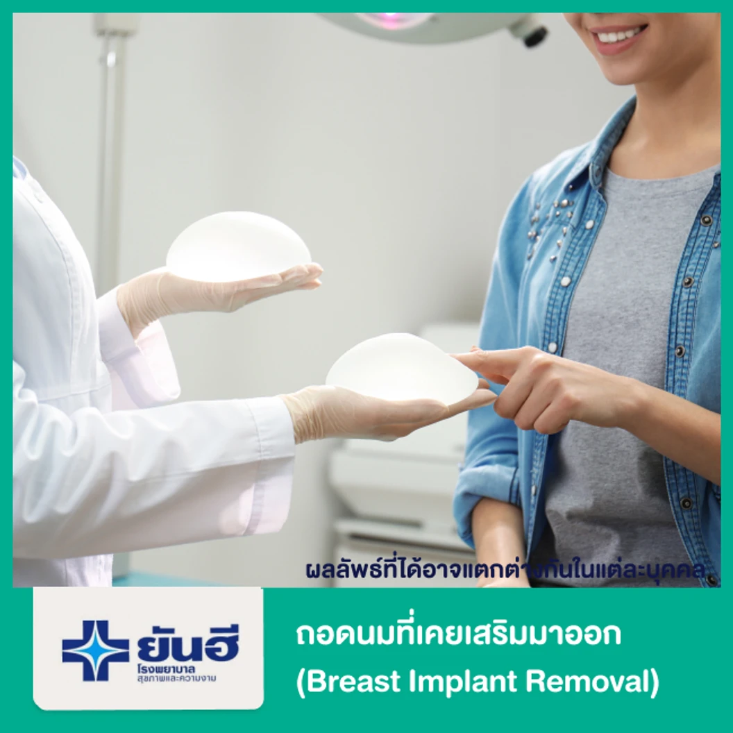 ถอดนมที่เคยเสริมมาออก (Breast Implant Removal)