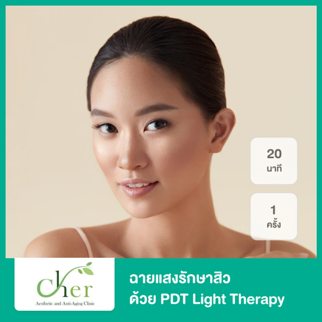ฉายแสงรักษาสิว ด้วย PDT Light Therapy 20 นาที 1 ครั้ง