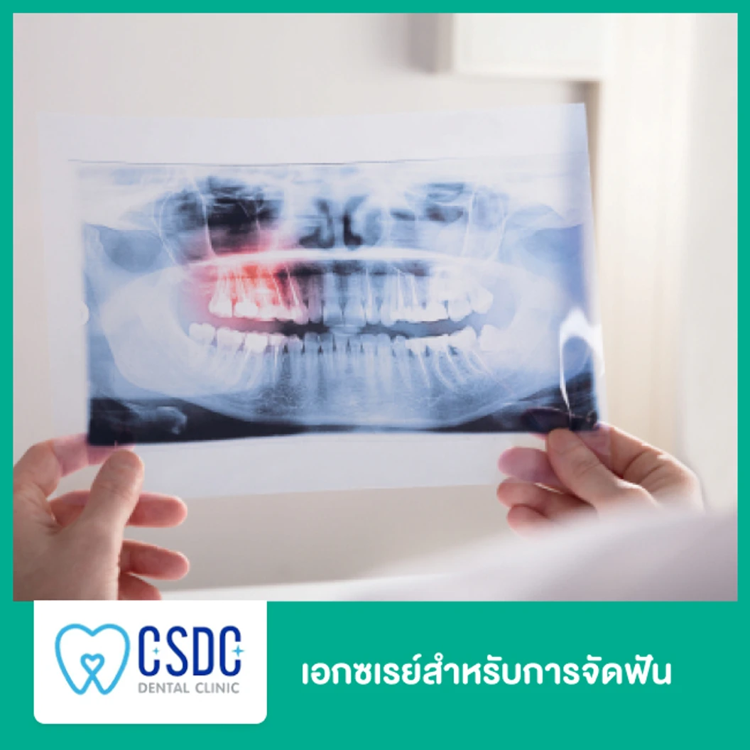 เอกซเรย์สำหรับการจัดฟัน