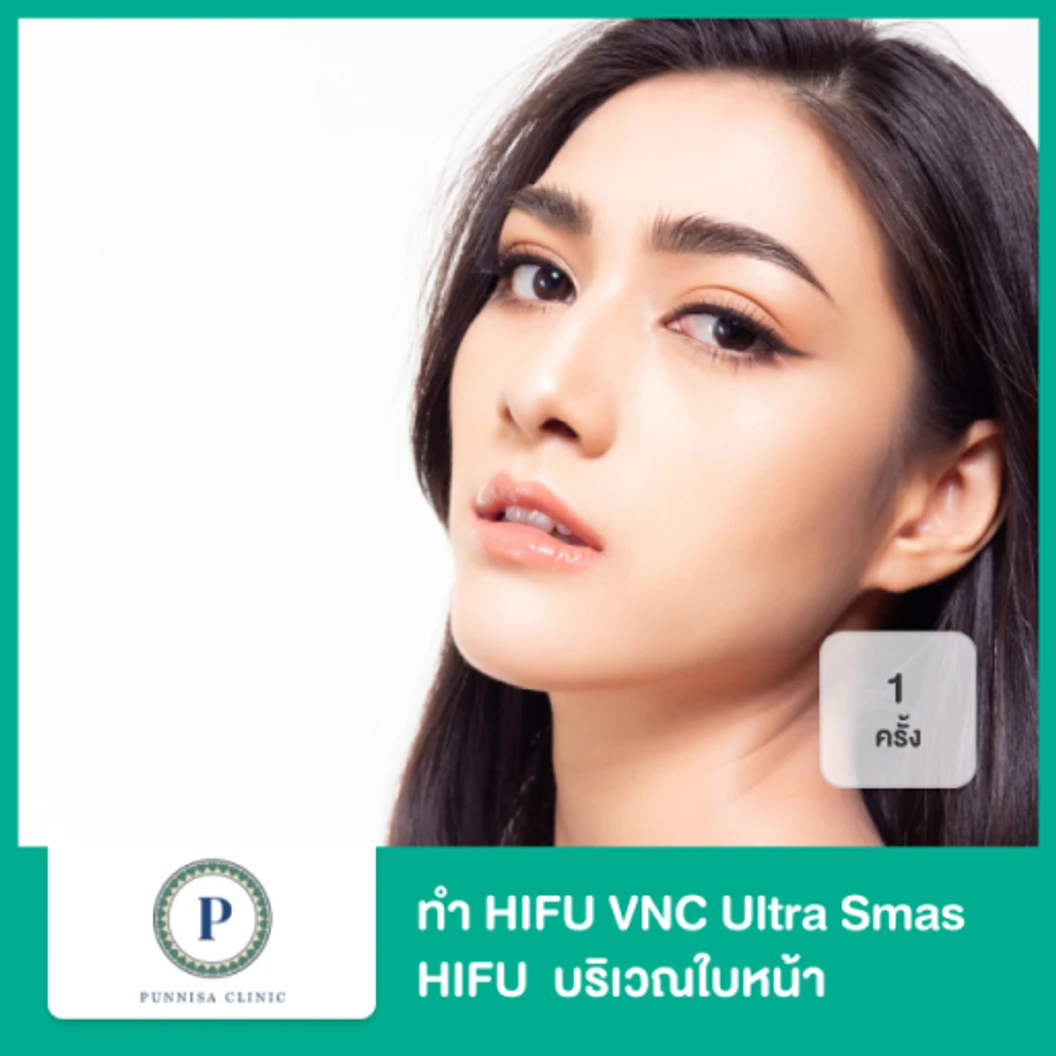 ทำ HIFU VNC Ultra Smas HIFU ไม่จำกัดช็อต ขึ้นอยู่กับแพทย์ประเมิน บริเวณใบหน้า 1 ครั้ง