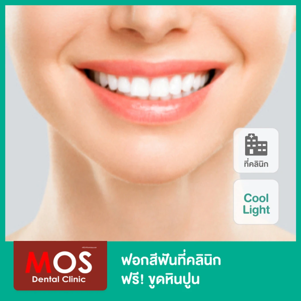 ฟอกสีฟันที่คลินิกด้วยระบบ Cool Light พร้อมขูดหินปูน