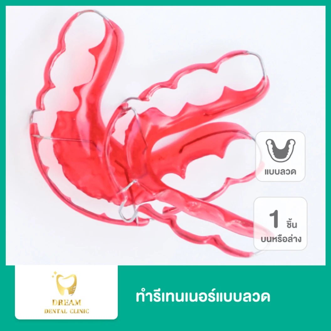 ทำรีเทนเนอร์แบบลวด 1 ชิ้น ฟันบนหรือล่าง