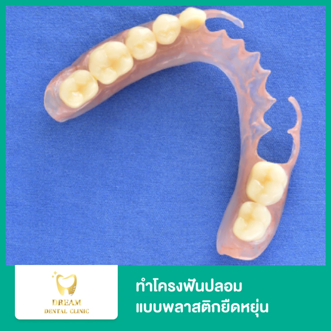 ทำโครงฟันปลอม แบบพลาสติกยืดหยุ่น ชนิดถอดได้ พร้อมฟันซี่แรก 1 ซี่
