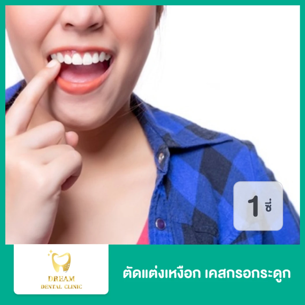 ตัดแต่งเหงือก เคสกรอกระดูก สำหรับฟัน 1 ซี่