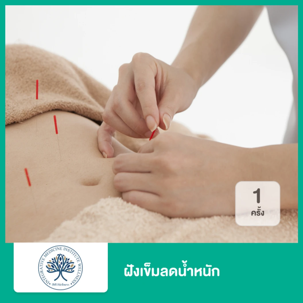 ฝังเข็มลดน้ำหนัก 1 ครั้ง