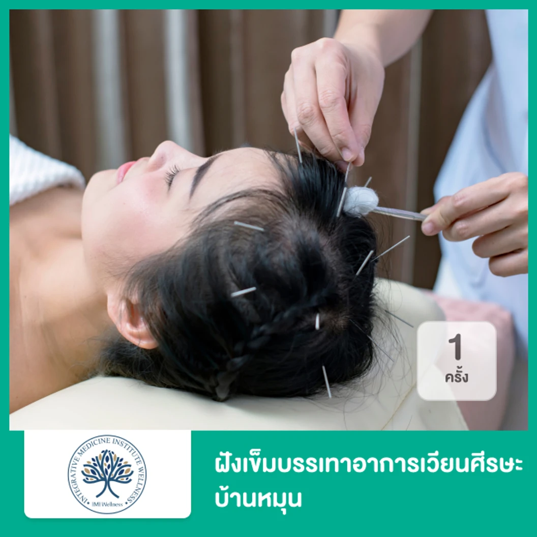 ฝังเข็มบรรเทาอาการเวียนศีรษะ บ้านหมุน 1 ครั้ง