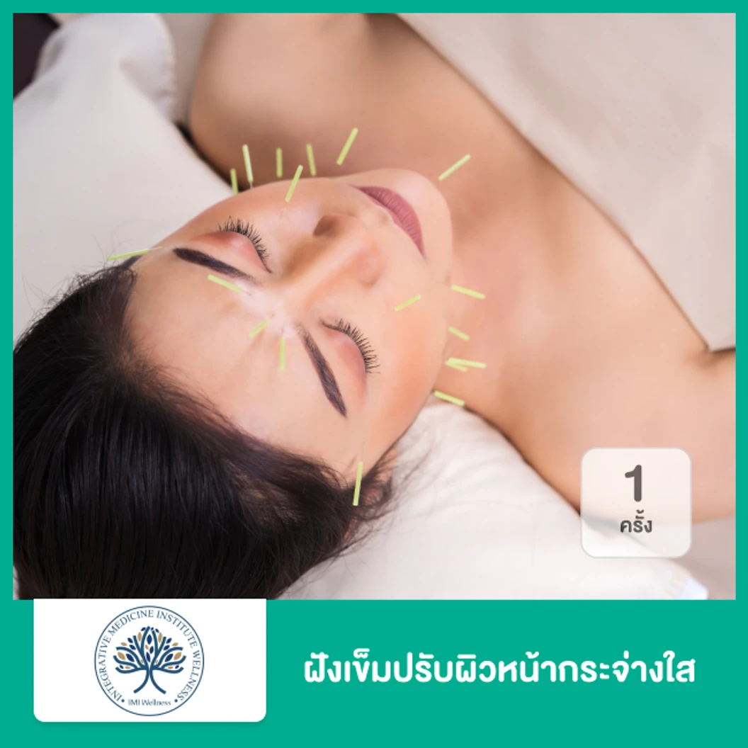 ฝังเข็มปรับผิวหน้ากระจ่างใส 1 ครั้ง